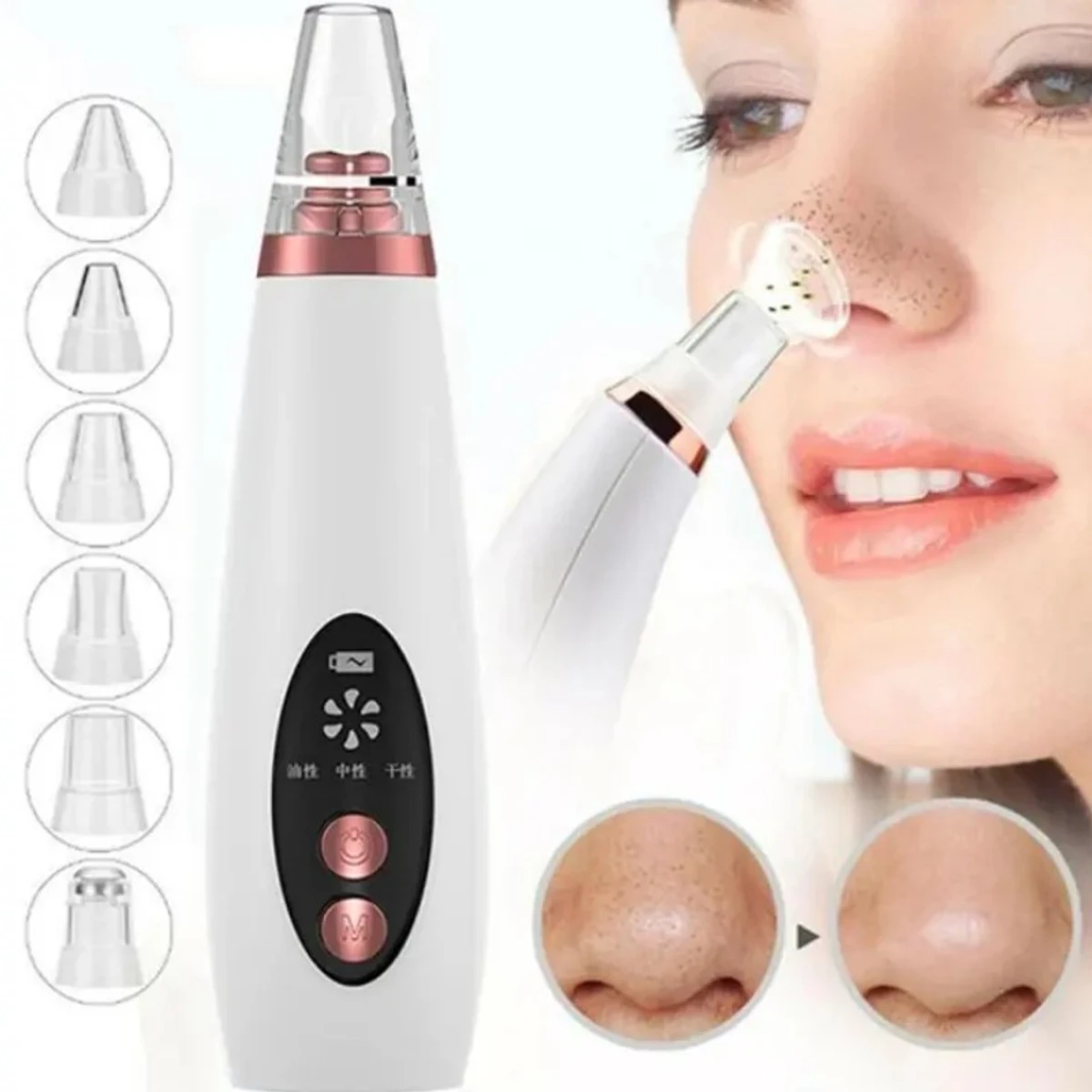 Multi Functional Black Head Remover