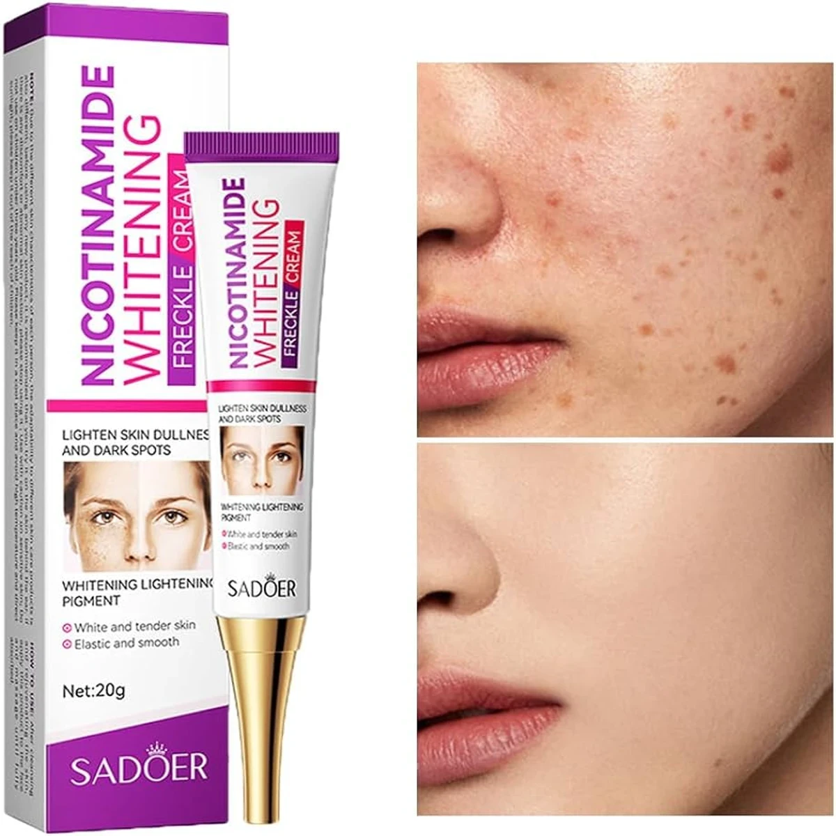 Freckle Removal Cream Moisturizing Moisturizing